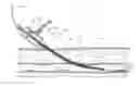 Fig. 01 - Devices for creation of multiple vascular access sites