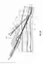 Fig. 08 - Devices for creation of multiple vascular access sites