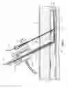 Fig. 13 - Devices for creation of multiple vascular access sites