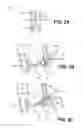 Fig. 03 - VACUUM-ASSISTED PANCREATICOBILIARY CANNULATION