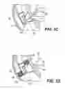 Fig. 05 - VACUUM-ASSISTED PANCREATICOBILIARY CANNULATION