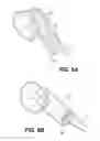 Fig. 10 - VACUUM-ASSISTED PANCREATICOBILIARY CANNULATION