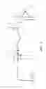 Fig. 03 - SUCTION DEVICE AND DRESSING