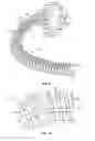 Fig. 08 - Dispensing fluid from an infusion pump system