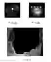 Fig. 03 - Method and apparatus for skin stabilization and positioning