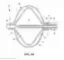 Fig. 06 - Compliant balloon with liquid injection