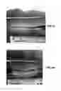 Fig. 07 - MICROWAVE TREATMENT DEVICES AND METHODS