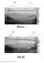 Fig. 08 - MICROWAVE TREATMENT DEVICES AND METHODS