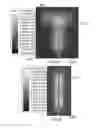 Fig. 35 - MICROWAVE TREATMENT DEVICES AND METHODS