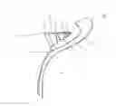 Fig. 01 - Method and apparatus for providing arthroscopic microfracture therapy