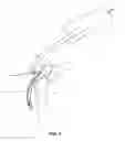 Fig. 02 - Method and apparatus for providing arthroscopic microfracture therapy