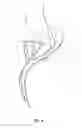 Fig. 07 - Method and apparatus for providing arthroscopic microfracture therapy