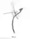 Fig. 14 - Method and apparatus for providing arthroscopic microfracture therapy