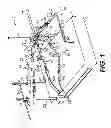 Fig. 02 - Surgical process for anterior hip replacement