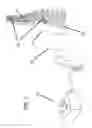 Fig. 02 - SURGICAL DISTRACTION DEVICE WITH EXTERNAL ACTIVATION