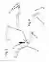 Fig. 04 - SURGICAL DISTRACTION DEVICE WITH EXTERNAL ACTIVATION
