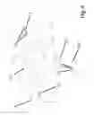 Fig. 06 - SURGICAL DISTRACTION DEVICE WITH EXTERNAL ACTIVATION