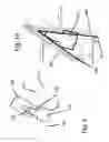 Fig. 08 - SURGICAL DISTRACTION DEVICE WITH EXTERNAL ACTIVATION