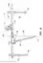 Fig. 05 - Method and apparatus for performing anterior hip surgery