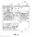 Fig. 11 - Method and apparatus for performing anterior hip surgery