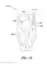 Fig. 18 - Method and apparatus for performing anterior hip surgery