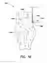 Fig. 19 - Method and apparatus for performing anterior hip surgery