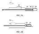 Fig. 04 - INTRAOCULAR LENS PERIPHERAL SURGICAL SYSTEMS