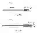 Fig. 05 - INTRAOCULAR LENS PERIPHERAL SURGICAL SYSTEMS