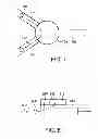 Fig. 08 - INTRAOCULAR LENS PERIPHERAL SURGICAL SYSTEMS