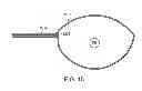 Fig. 13 - INTRAOCULAR LENS PERIPHERAL SURGICAL SYSTEMS
