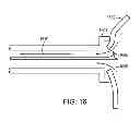 Fig. 14 - INTRAOCULAR LENS PERIPHERAL SURGICAL SYSTEMS
