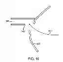 Fig. 16 - INTRAOCULAR LENS PERIPHERAL SURGICAL SYSTEMS