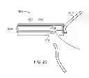 Fig. 17 - INTRAOCULAR LENS PERIPHERAL SURGICAL SYSTEMS