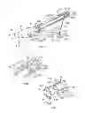 Fig. 03 - Apparatus and methods for occluding an anatomical structure