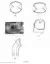 Fig. 09 - Tissue removal systems with articulating cutting heads