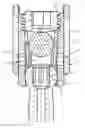 Fig. 01 - Readjustable polyaxial pedicle screw