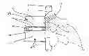 Fig. 01 - METHODS AND DEVICES FOR COOLING SPINAL TISSUE