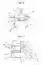 Fig. 02 - METHODS AND DEVICES FOR COOLING SPINAL TISSUE