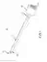 Fig. 02 - ORTHOPEDIC TAMP AND BONE STABILIZATION MATERIAL DELIVERY DEVICE