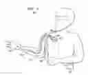 Fig. 05 - Neural prosthesis system and method of control