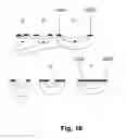 Fig. 22 - Implant unit for modulation of small diameter nerves