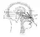 Fig. 01 - Self-administrable method, system and apparatus  for non-invasive neurostimulation therapy of the brain