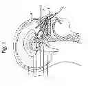 Fig. 02 - Self-administrable method, system and apparatus  for non-invasive neurostimulation therapy of the brain
