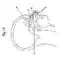 Fig. 09 - Self-administrable method, system and apparatus  for non-invasive neurostimulation therapy of the brain