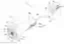 Fig. 01 - TREATMENT DEVICE USING HIGH FREQUENCY