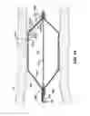 Fig. 02 - Thin-film composite retrievable endovascular devices and method of use
