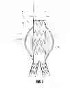 Fig. 09 - Stent graft