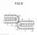 Fig. 07 - Stent