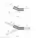 Fig. 04 - Membrane for covering a peripheral surface of a stent