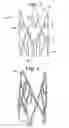Fig. 02 - SIX CELL INNER STENT DEVICE FOR PROSTHETIC MITRAL VALVES
